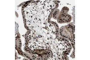 Immunohistochemical staining of human placenta with ZNF250 polyclonal antibody  shows strong nuclear positivity in trophoblastic cells at 1:50-1:200 dilution. (ZNF250 antibody)