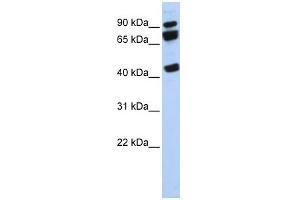WB Suggested Anti-DDX17 Antibody Titration:  0.