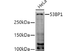 Western blot analysis of extracts of HeLa cells, using 53BP1 antibody (ABIN6128833, ABIN6149414, ABIN6149415 and ABIN6221431) at 1:1000 dilution. (TP53BP1 antibody  (AA 1763-1977))