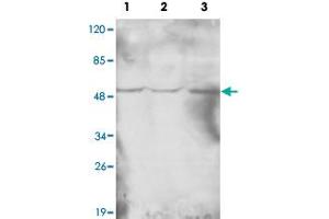 Western blot analysis of HAT1 monoclonal antibody  at 1 : 1000 dilution. (HAT1 antibody  (N-Term))