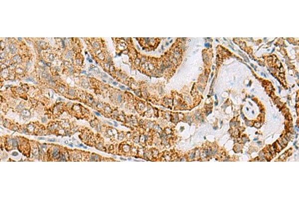 FARP2 antibody