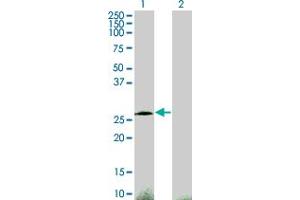 Western Blot analysis of CITED1 expression in transfected 293T cell line by CITED1 monoclonal antibody (M06), clone 2H6.