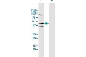 Western Blot analysis of SDC2 expression in transfected 293T cell line by SDC2 MaxPab polyclonal antibody. (Syndecan 2 antibody  (AA 19-201))