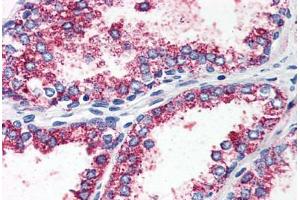 Prostate, Human: Formalin-Fixed, Paraffin-Embedded (FFPE) (HTR2A antibody  (N-Term))