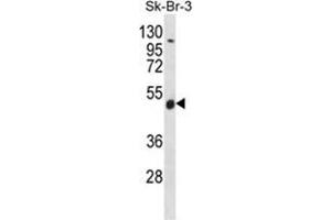 WDR34 Antibody (Center) western blot analysis in SK-BR-3 cell line lysates (35 µg/lane).