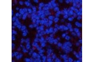 Immunofluorescence analysis of Mouse spleen tissue using PDGFRA Monoclonal Antibody at dilution of 1:200. (PDGFRA antibody)