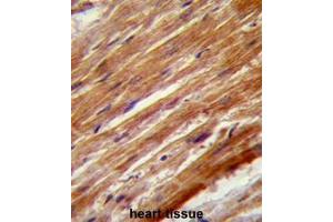 Formalin fixed and paraffin embedded human heart stained with MEKK4 Antibody (Center) Cat. (MAP3K4 antibody  (Middle Region))