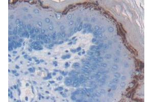 DAB staining on IHC-P; Samples: Mouse Esophagus Tissue (WFDC5 antibody  (AA 1-126))
