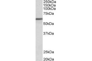 ABIN185457 (1µg/ml) staining of Human Breast cancer lysate (35µg protein in RIPA buffer). (ZNF703 antibody  (Internal Region))