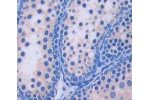 Used in DAB staining on fromalin fixed paraffin- embedded Kidney tissue (PEX1 antibody  (AA 172-377))