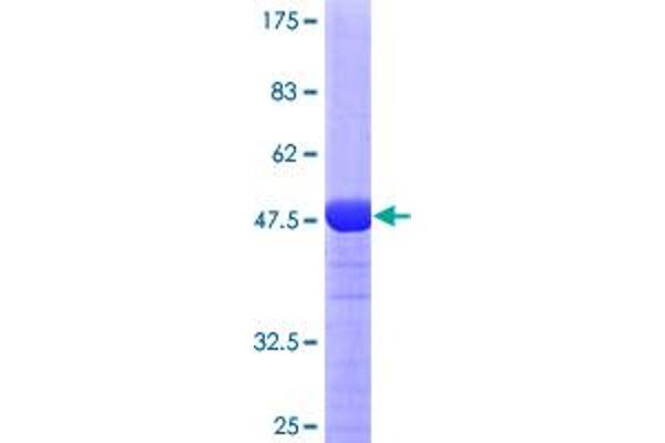 RAB11A Protein (AA 1-216) (GST tag)