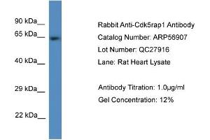 Western Blotting (WB) image for anti-CDK5 Regulatory Subunit Associated Protein 1 (CDK5RAP1) (C-Term) antibody (ABIN2774168)