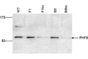 Western Blot results of Rabbit anti-PHF8 antibody Western Blot results of Rabbit anti-PHF8 antibody.