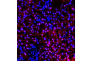 Immunofluorescence (Paraffin-embedded Sections) (IF (p)) image for anti-RB-Associated KRAB Zinc Finger (RBAK) antibody (ABIN7075383)