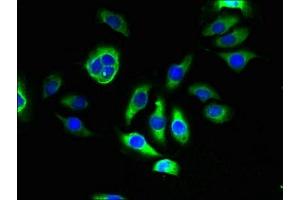 Immunofluorescent analysis of A549 cells using ABIN7173063 at dilution of 1:100 and Alexa Fluor 488-congugated AffiniPure Goat Anti-Rabbit IgG(H+L) (TMEM143 antibody  (AA 8-278))