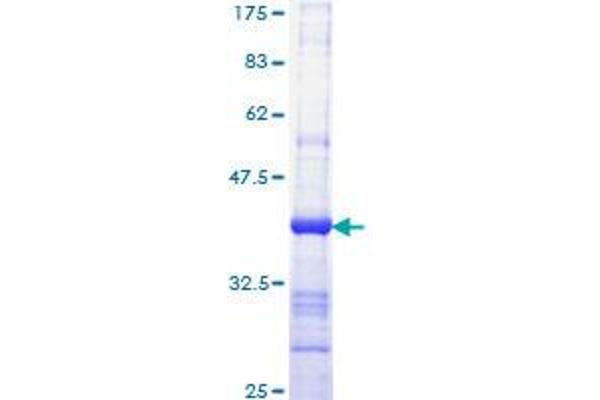 IQGAP1 Protein (AA 611-710) (GST tag)