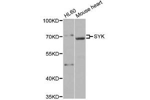 Western blot analysis of extracts of various cell lines, using SYK antibody. (SYK antibody)