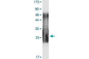 Image no. 2 for Tumor Necrosis Factor (Ligand) Superfamily, Member 11 (TNFSF11) (AA 158-317) protein (His-DYKDDDDK-Strep II Tag) (ABIN1323211)