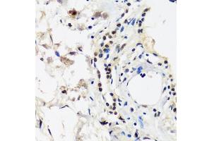 Immunohistochemistry of paraffin-embedded human lung using C antibody (ABIN7266546) at dilution of 1:100 (40x lens). (CAND1 antibody  (AA 750-980))