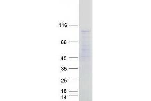 Validation with Western Blot (MED24 Protein (Transcript Variant 1) (Myc-DYKDDDDK Tag))