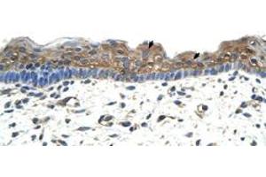 Immunohistochemical staining (Formalin-fixed paraffin-embedded sections) of human skin with APOBEC2 polyclonal antibody  at 4-8 ug/mL working concentration.