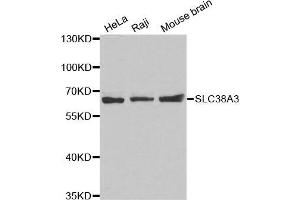 Western blot analysis of extracts of various cell lines, using SLC38A3 antibody. (SLC38A3 antibody  (AA 1-65))