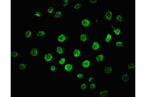 Immunofluorescence staining of A549 cells with ABIN7150777 at 1:100, counter-stained with DAPI. (DUSP5 antibody  (AA 56-181))