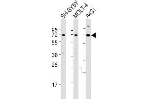 All lanes : Anti-HTR2C Antibody (Center) at 1:4000 dilution Lane 1: SH-SY5Y whole cell lysates Lane 2: MOLT-4 whole cell lysates Lane 3: A431 whole cell lysates Lysates/proteins at 20 μg per lane. (HTR2C antibody  (AA 274-308))