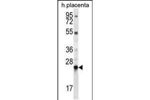 Western blot analysis in human placenta tissue lysates (35ug/lane). (LHFPL1 antibody  (N-Term))