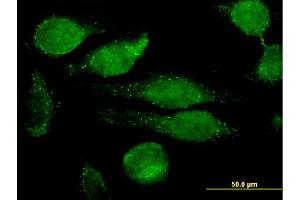 Immunofluorescence of monoclonal antibody to GRN on HeLa cell. (Granulin antibody  (AA 494-593))