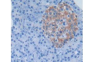 Used in DAB staining on fromalin fixed paraffin- embedded Kidney tissue (KREMEN1 antibody  (AA 157-390))