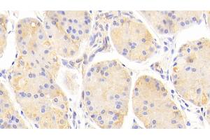 Detection of a2M in Human Stomach Tissue using Polyclonal Antibody to Alpha-2-Macroglobulin (a2M) (alpha 2 Macroglobulin antibody  (AA 616-856))