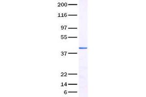Validation with Western Blot (MMP1 Protein (Transcript Variant 1))