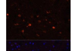 Immunofluorescence analysis of Mouse brain using S100B Polyclonal Antibody at dilution of 1:100. (S100B antibody)