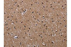 The image on the left is immunohistochemistry of paraffin-embedded Human brain tissue using ABIN7128956(CLDND1 Antibody) at dilution 1/50, on the right is treated with fusion protein.