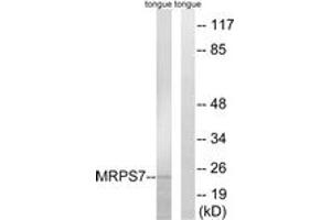 Western blot analysis of extracts from rat tongue cells, using MRPS7 Antibody. (MRPS7 antibody  (AA 91-140))