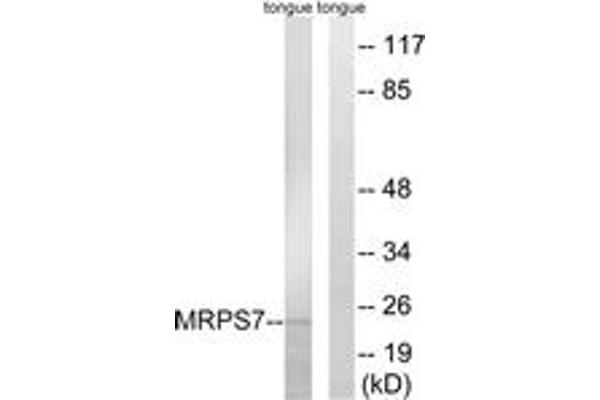 MRPS7 antibody  (AA 91-140)
