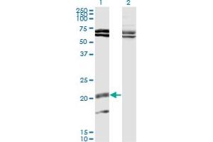 Western Blot analysis of IL17B expression in transfected 293T cell line by IL17B monoclonal antibody (M02), clone 1G6.