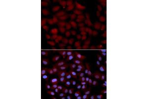 Immunofluorescence analysis of U2OS cells using TNK2 antibody (ABIN5971357). (TNK2 antibody)