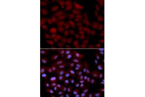 Immunofluorescence analysis of U2OS cells using TNK2 antibody (ABIN5971357). (TNK2 antibody)