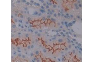 Figure. (MUC13 antibody  (AA 174-404))