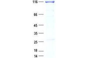 Validation with Western Blot (CDT2/RAMP Protein (GST tag,His tag))