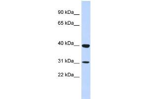 WB Suggested Anti-ZNF660 Antibody Titration:  0.