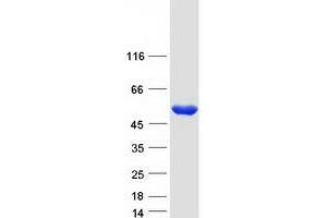 Western Blotting (WB) image for Homogentisate 1,2-Dioxygenase (HGD) protein (Myc-DYKDDDDK Tag) (ABIN2722962)