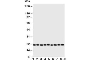 Western blot testing of Cytoglobin antibody and Lane 1:  rat brain;  2: (r) small intestine;  3: (r) liver;  4: (r) kidney;  5: human SGC;  6: (h) COLO320;  7: SMMC-7721;  8: PANC;  9: HeLa cell lysate.