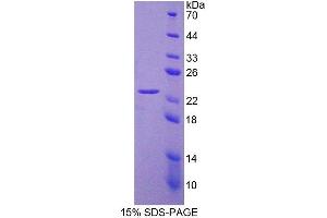 Image no. 1 for Myotubularin Related Protein 9 (MTMR9) (AA 1-167) protein (His tag) (ABIN4990443)