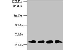 Western blot All lanes: MRPL18 antibody at 8 μg/mL Lane 1: U251 whole cell lysate Lane 2: THP-1 whole cell lysate Lane 3: PC-3 whole cell lysate Lane 4: U87 whole cell lysate Secondary Goat polyclonal to rabbit IgG at 1/10000 dilution Predicted band size: 21 kDa Observed band size: 21 kDa (MRPL18 antibody  (AA 14-180))