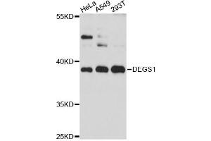 Western blot analysis of extracts of various cell lines, using DEGS1 antibody (ABIN6294024) at 1:3000 dilution. (DEGS1 antibody)