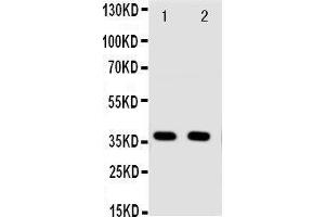 Anti-Annexin A10 antibody, Western blotting Lane 1: A549 Cell Lysate Lane 2: A549 Cell Lysate (Annexin a10 antibody  (C-Term))