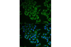 Immunofluorescence analysis of A549 cells using CD247 antibody.